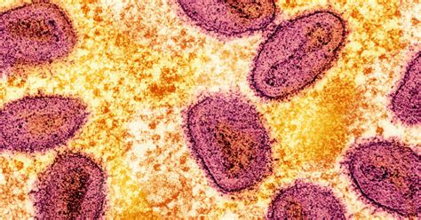 sex scandal cases in the philippines 2024|Two more mpox cases detected in the Philippines — .